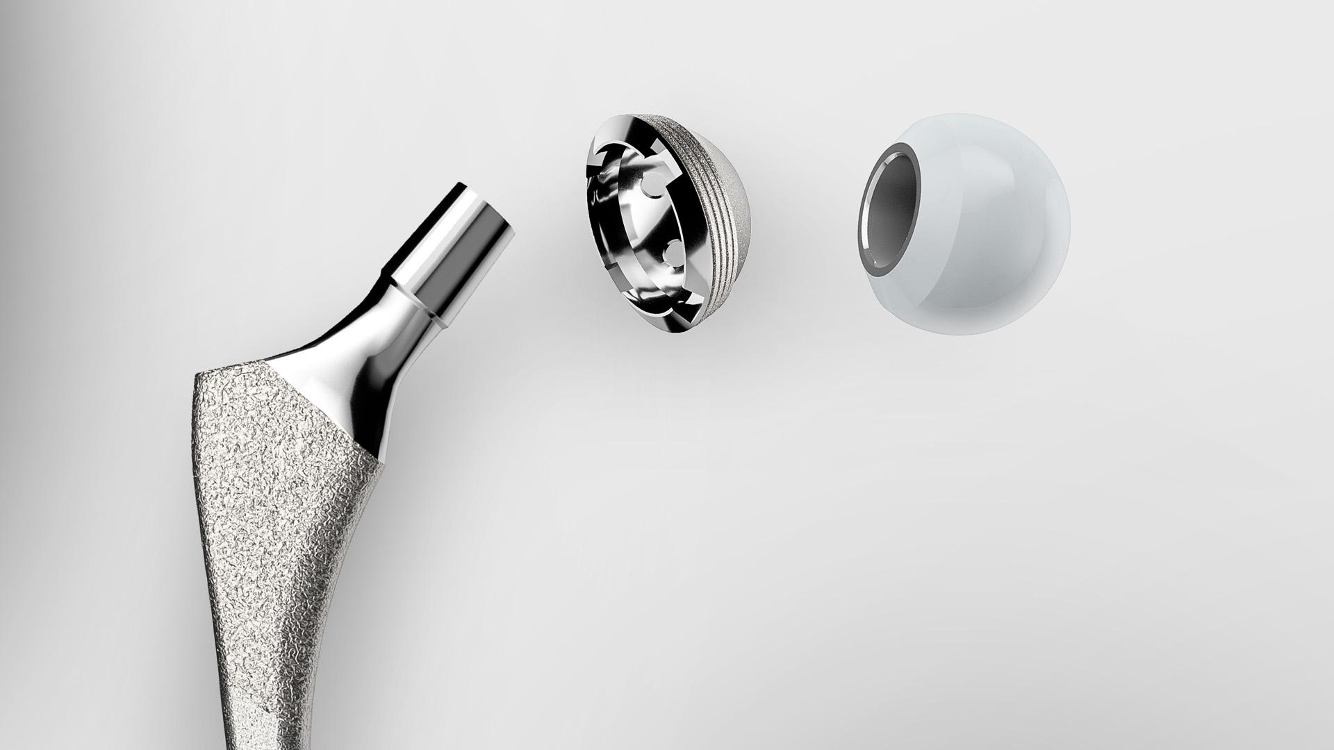 Ortopedik implantların üretim sürecine yönelik kalite eşiklerini ve çözümlerini keşfedin