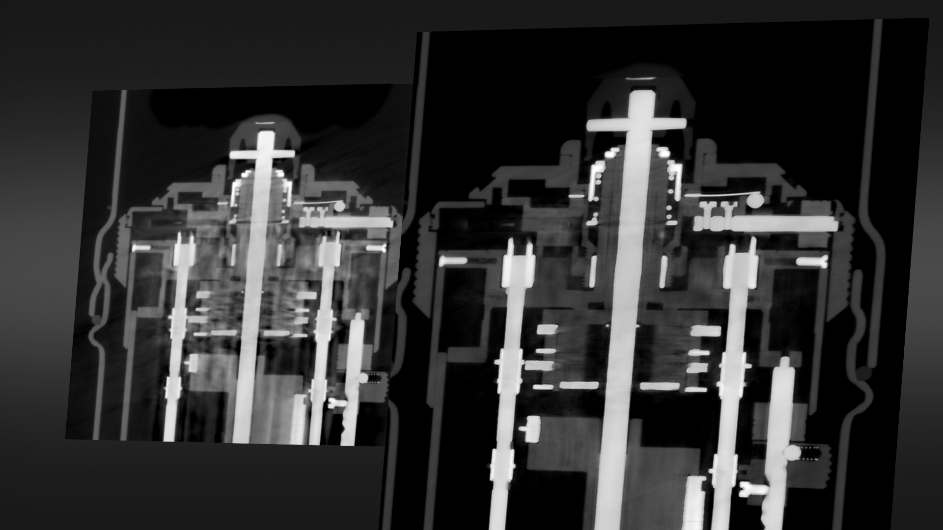Advanced Mixed Material Artifact Reduction (AMMAR)