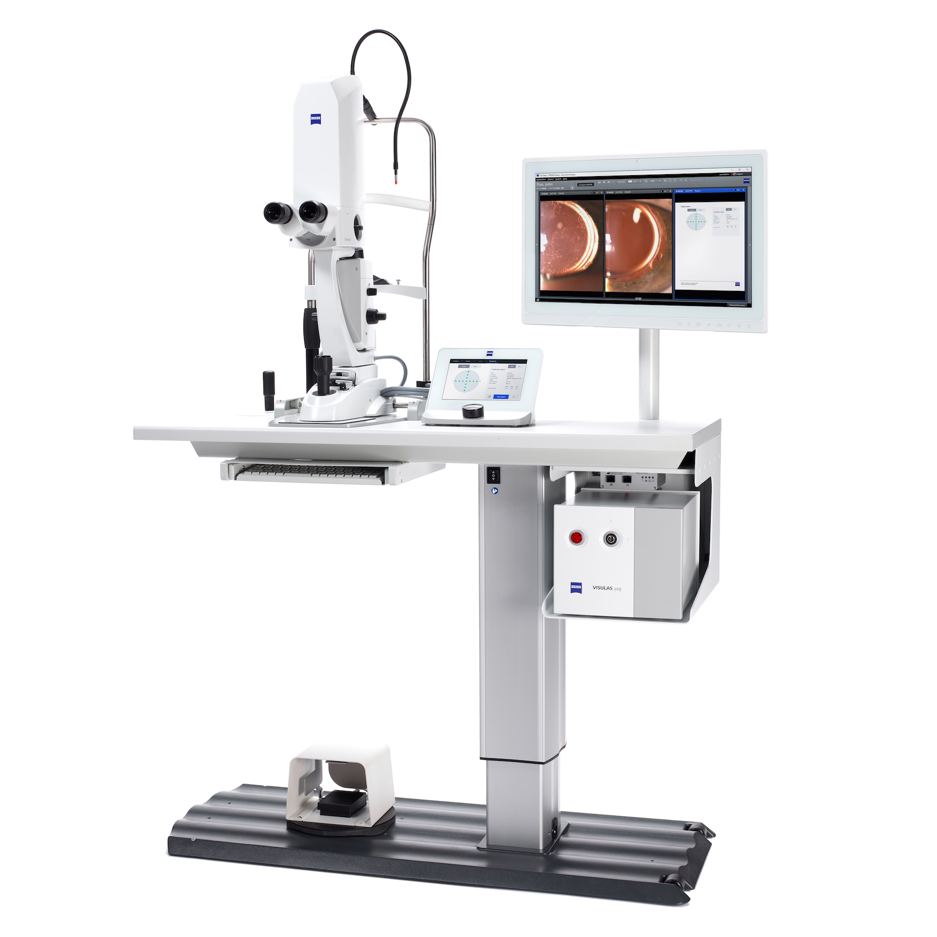 The VISULAS yag laser from ZEISS is a modern and compact laser workstation for safe and effective photodisruption.