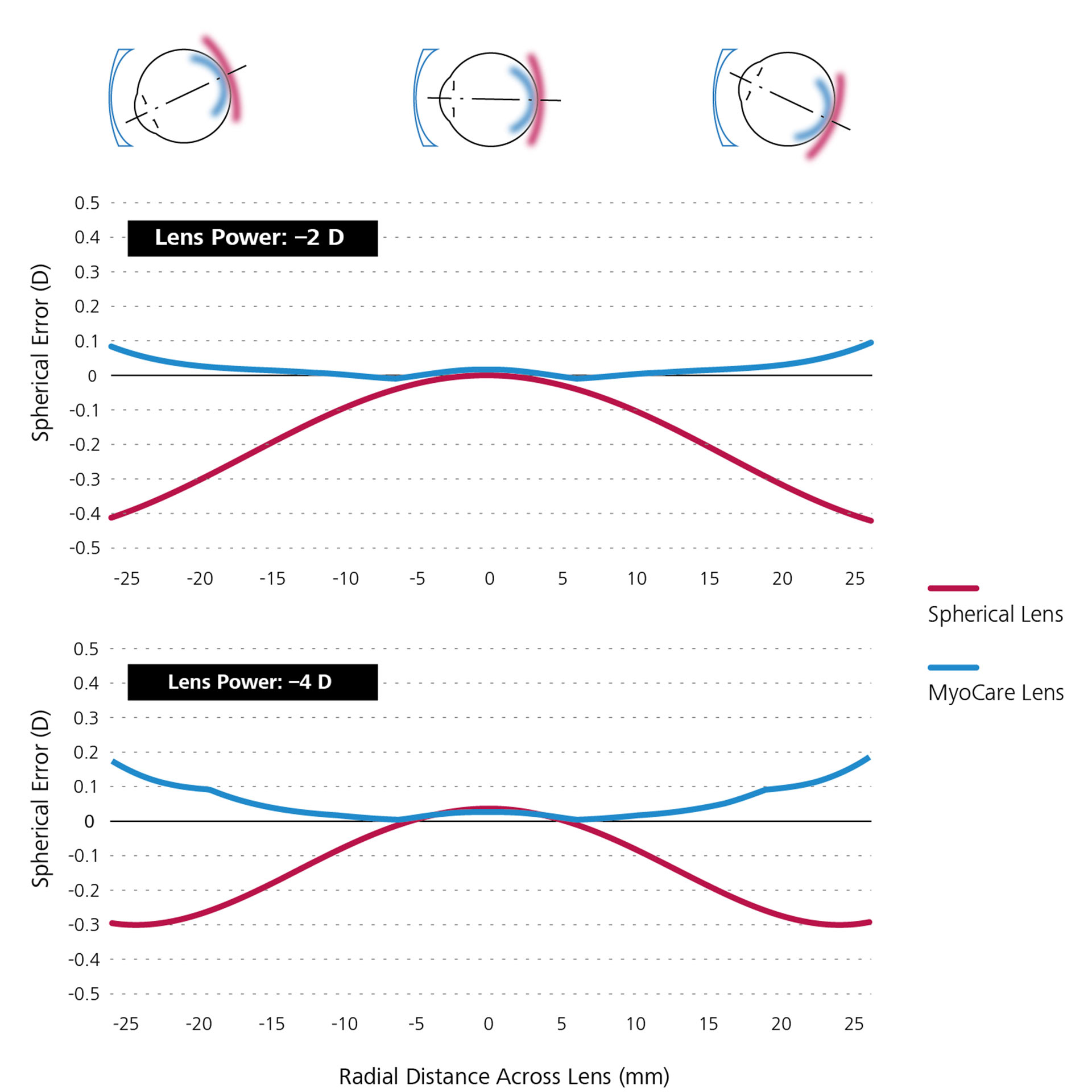 Siferik tek odaklı camların (kırmızı renkte) ve MyoCare gözlük camlarının (mavi renkte) karşılaştırmalı matematiksel simülasyonunu gösteren iki çizgi grafik.